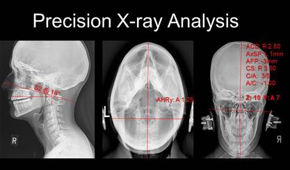 Precision X-ray Analysis